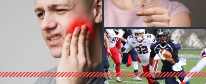 mouthguards image